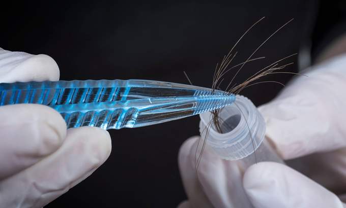 Tissue mineral analysis