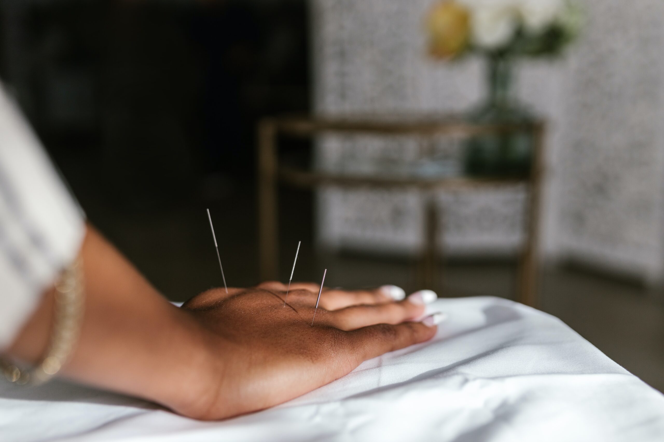 acupuncture, acupuncture melbourne, best acupuncturist melbounre, acupuncture for allergies, acupuncture for hayfever, acupuncture for eczema, acupuncture for allergic rhinitis, allergies, hayfever, natural medicine for allergies