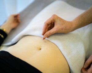 acupuncture Glen Iris